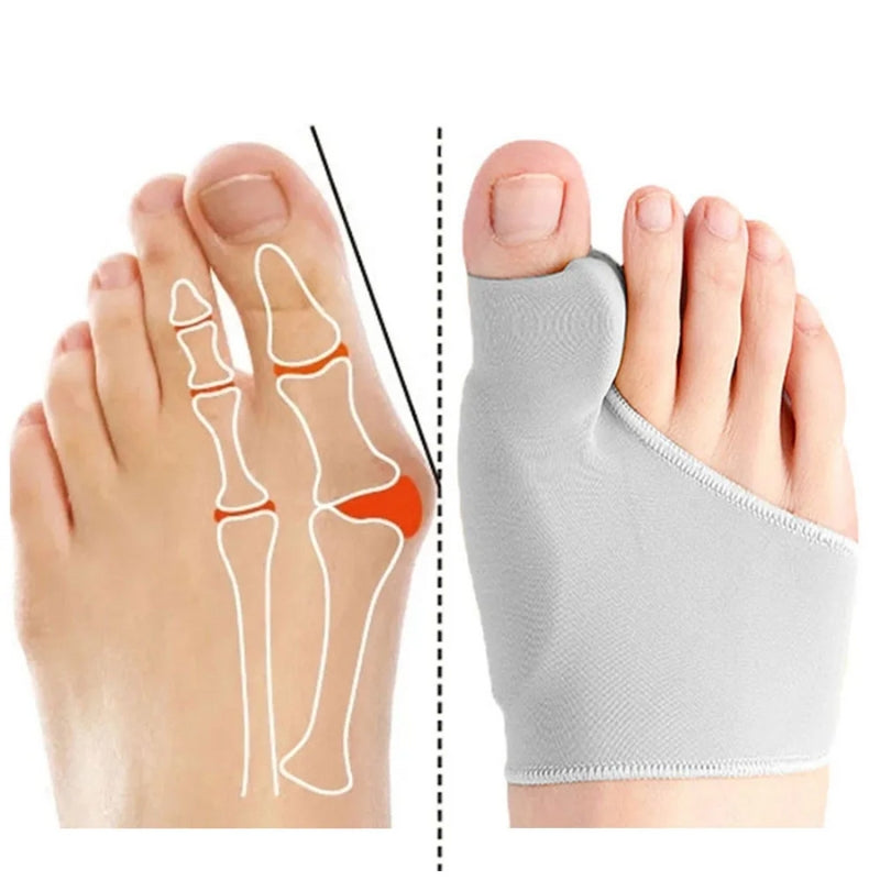 Peak - Bunion Corrector